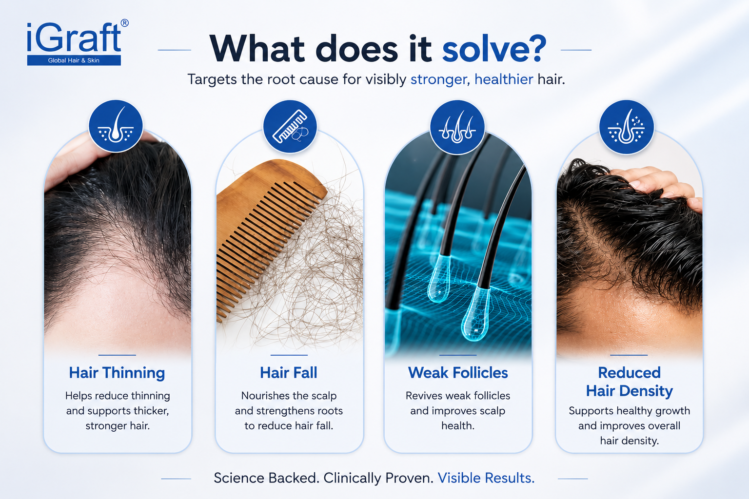 iGraft 1 Month Hair Fall + Dandruff Kit | Complete Hair & Scalp Care Routine
