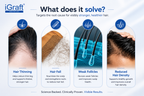 iGraft Hair Booster Tonic Plus Hair Serum | Advanced Hair Growth Serum | 30ml