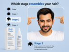 iGraft 1 Month Hair Fall Advanced Kit