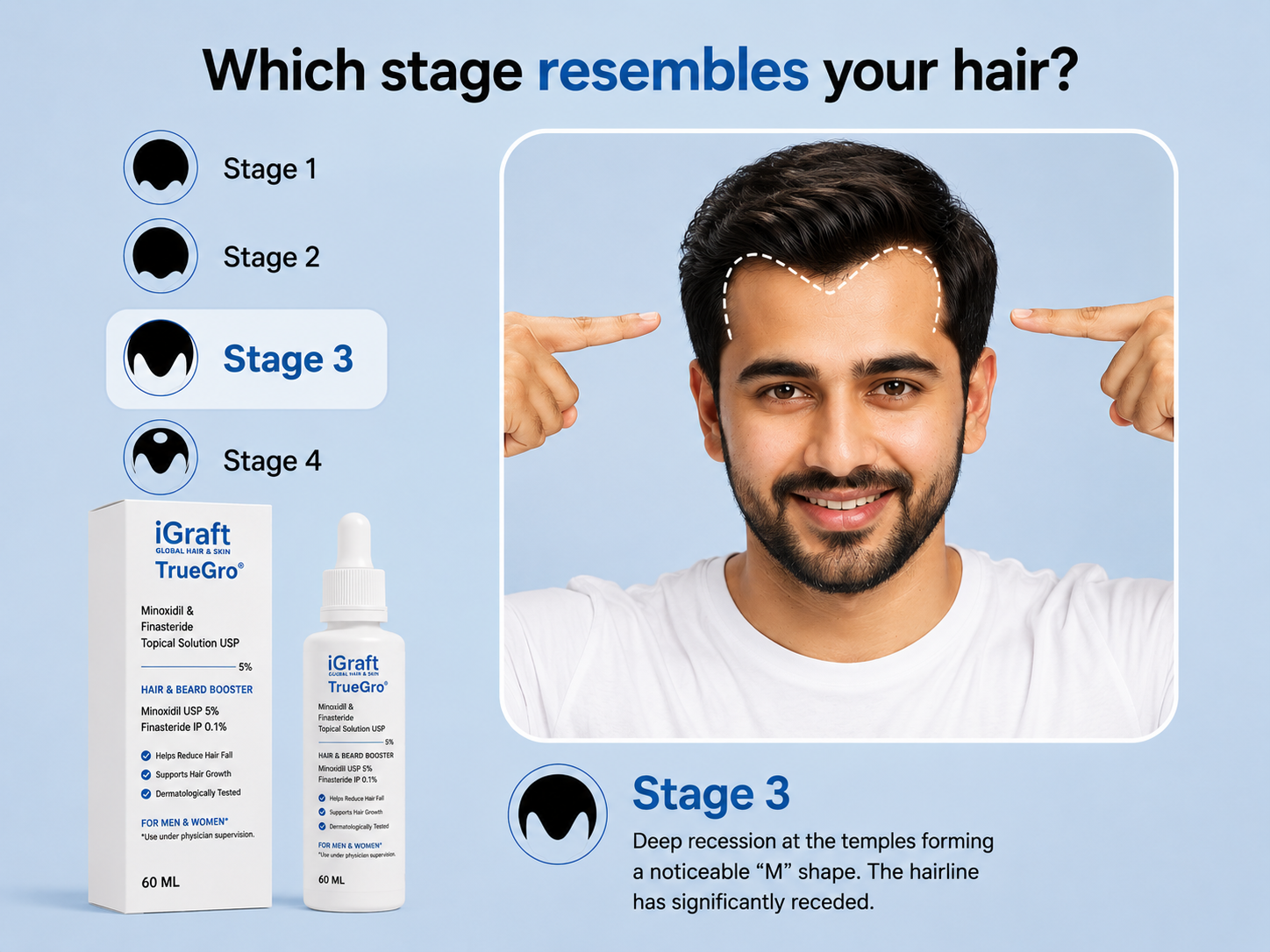 iGraft 1 Month Hair Fall Advanced Kit