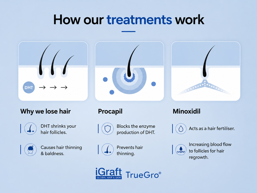 iGraft TrueGro Minoxidil 5% + Finasteride 0.1% | Hair Growth Solution 60ml