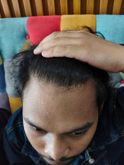 Before